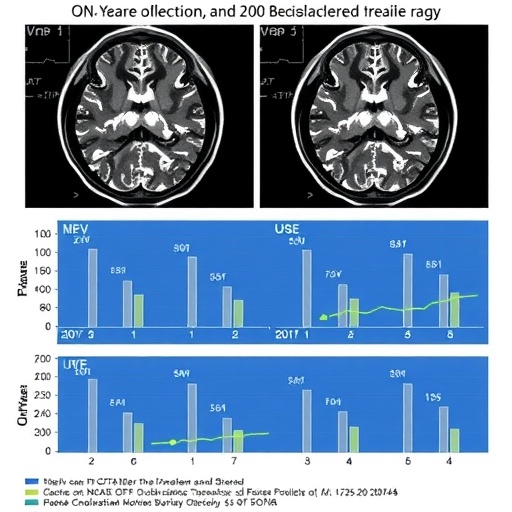 One-Year Outcomes After Endovascular Treatment for Large Acute Ischemic Strokes