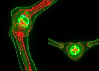 Oxypaeoniflorin Prevents Titanium Particle-Induced Bone Loss by Reprogramming Osteoclast Mitochondria via Nrf2