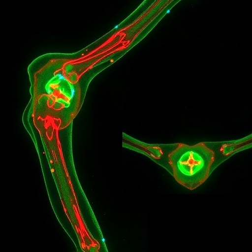 Oxypaeoniflorin Prevents Titanium Particle-Induced Bone Loss by Reprogramming Osteoclast Mitochondria via Nrf2