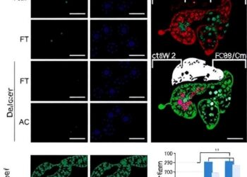 p38β-Mediated BiP Phosphorylation Drives Stemness, Chemoresistance by Suppressing UPR in Liver Cancer