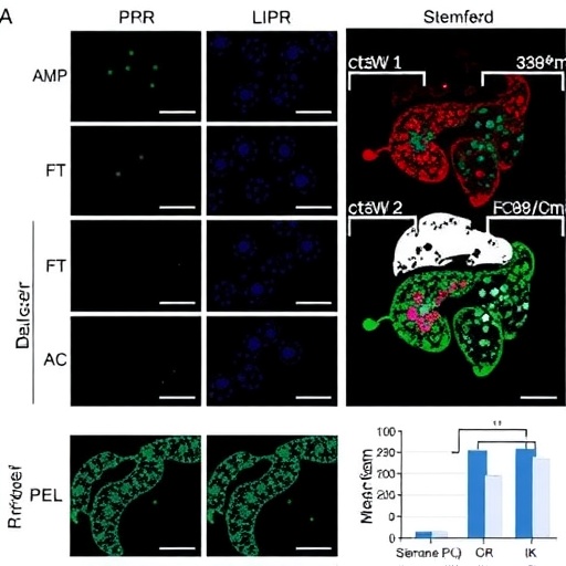 p38β-Mediated BiP Phosphorylation Drives Stemness, Chemoresistance by Suppressing UPR in Liver Cancer