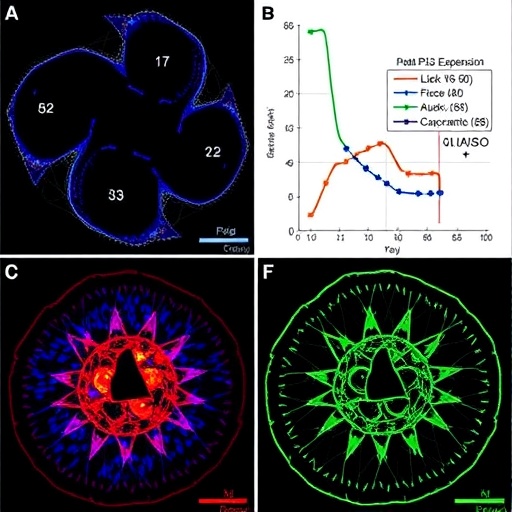 p53 expression patterns link KAISO and field cancerization in oral cancer