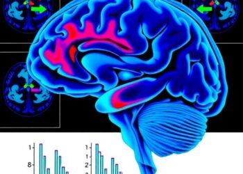 Parkinson’s Freezing of Gait Linked to State-Dependent Basal Forebrain-Cortical Gradient Failure