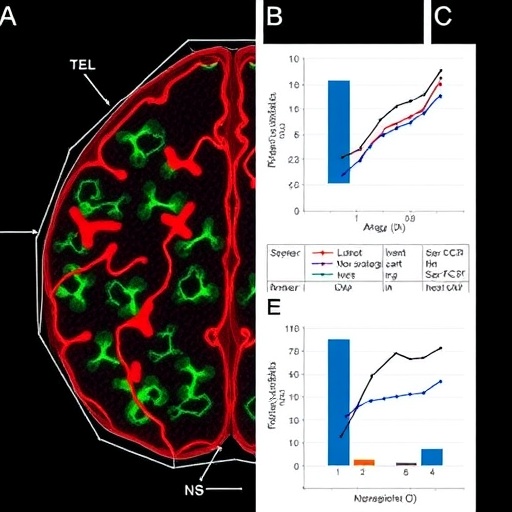 Parkinson’s-linked LRRK2 mutation disrupts astrocyte development and induces senescence-like changes