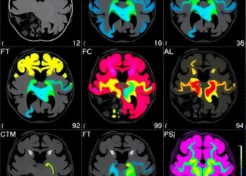 Pathogenic MECP2 Variants Reveal Broader Neurological Spectrum Beyond Rett Syndrome