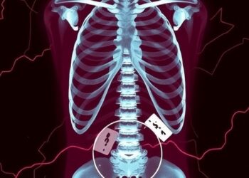 Postmortem Metabolomics Reveals Agonal Death Processes in Opioid Overdoses and Hangings