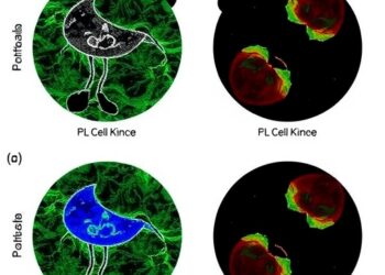 PRAME-Specific T-Cell Therapy Used in Adolescent With Metastatic Kidney Tumor