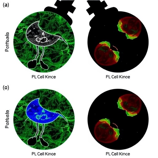 PRAME-Specific T-Cell Therapy Used in Adolescent With Metastatic Kidney Tumor