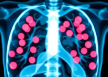 Preoperative Dual Immunotherapy Shows Promise in High-Risk Early HER2-Negative Breast Cancer
