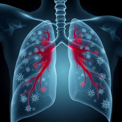 Pulmonary Aspergillosis Patterns and Hospital Burden Shifted Across 15 Years, Including COVID-19