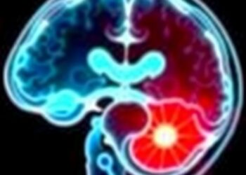 Radiopharmaceutical could benefit metastatic prostate cancer patients sooner