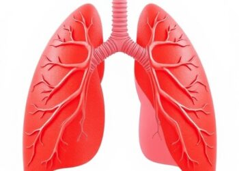 Rare Lung Condition Expands Celiac Disease’s Known Complications