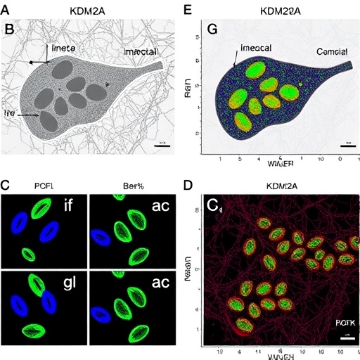 Removing KDM2A Demethylase Restores Antitumor Immunity in Liver Cancer