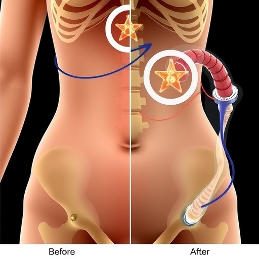 Revisional Roux-en-Y bypass after sleeve gastrectomy affects bone health in postmenopausal women