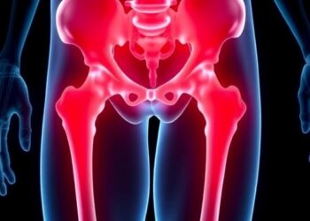 Risk model links intraoperative hypotension to clots after elderly hip surgery