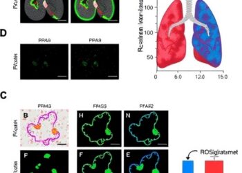 Rosiglitazone protects against renal ischemia-reperfusion-induced lung injury via HMGB1/MYH9-PPARγ pathway