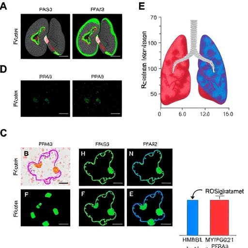 Rosiglitazone protects against renal ischemia-reperfusion-induced lung injury via HMGB1/MYH9-PPARγ pathway