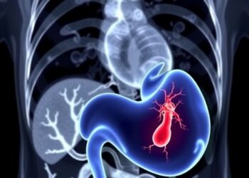 Ruptured Hepatic Artery Aneurysm Into Biliary Tract During LVAD Support Successfully Embolized