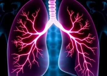 Safety of Liposomal Amphotericin B for Antifungal Prophylaxis After Bilateral Lung Transplantation