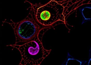 SELENOF and unfolded protein response crosstalk determines breast epithelial cell fate