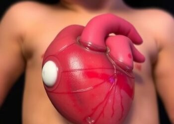 Severe Right Heart Failure After HeartMate 3 Implantation in a Small Child