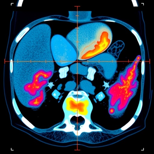 Sex Differences and Atherosclerosis-Linked CT Patterns in Abdominal Fat