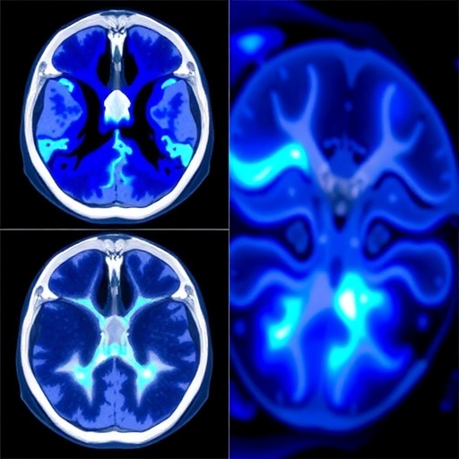 ShanghaiTech Researchers Develop Diffusion-Regularized Neural Representation to Reduce CT Metal Artifacts