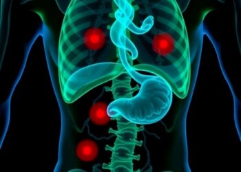 Skin Metastases from Hepatobiliary Cancers: A Systematic Review