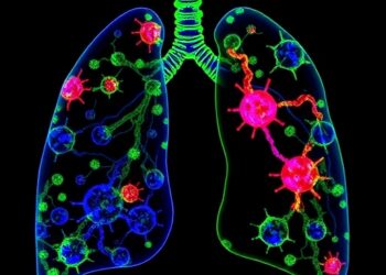 Small Cell Lung Cancer Relies on Targetable Nonsense-Mediated Decay for Immune Control