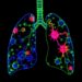 Small Cell Lung Cancer Relies on Targetable Nonsense-Mediated Decay for Immune Control