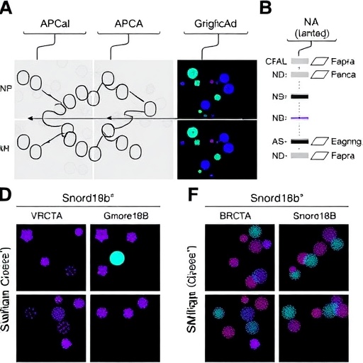 SNORD18B/SNORD18C-RPL23A Promotes Homologous Recombination Through BRCA1 Translation in Colorectal Cancer