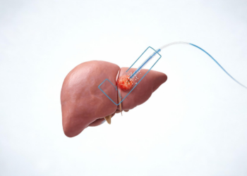 Correction Updates Conflict Disclosure in Liver Tumor Embolization Review