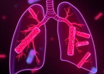 Stem Cell Vesicles Reprogram Macrophage Lipid Metabolism, Easing Sepsis-Induced Lung Injury
