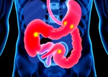 Stereotactic radiation shows favorable bowel-related quality of life in localized prostate cancer