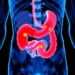Stereotactic radiation shows favorable bowel-related quality of life in localized prostate cancer