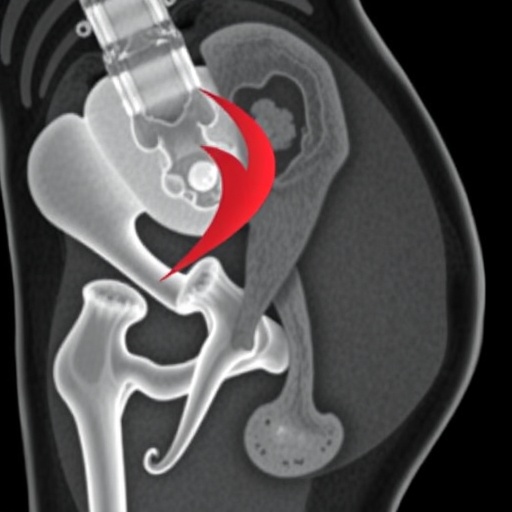Study Compares Imaging Methods for Mapping Anterolateral Thigh Perforators
