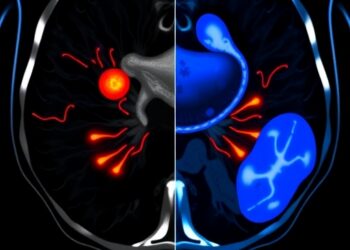 Study Compares SBRT and Hypofractionated IMRT for Intermediate-Risk Prostate Cancer