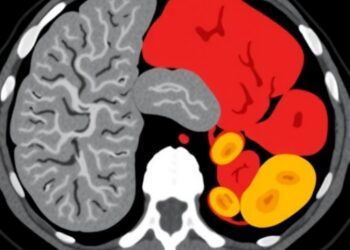 Study Evaluates Foundation Models for Organ-Level Classification Using CT Scans