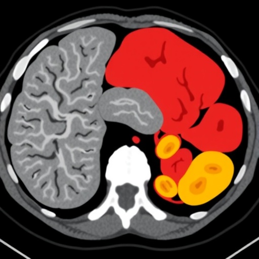 Study Evaluates Foundation Models for Organ-Level Classification Using CT Scans