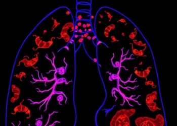 Study Explores PDLIM2 as Prognostic Biomarker and Treatment Target in Lung Adenocarcinoma