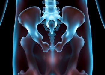 Study identifies fragility fracture risk factors in peritoneal dialysis patients