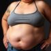 Study Links Obesity to Increased Cardiovascular Disease Risk