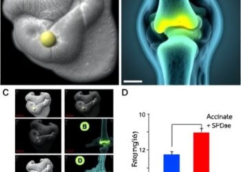 Succinate Worsens Obesity-Linked Osteoarthritis Through SUCNR1 Activation, Succinylation, and Mitochondrial Dysfunction