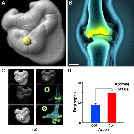 Succinate Worsens Obesity-Linked Osteoarthritis Through SUCNR1 Activation, Succinylation, and Mitochondrial Dysfunction