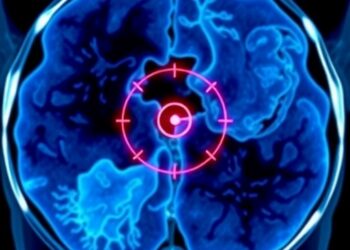 Targeted Focal Therapy Shows Promise Against Prostate Cancer