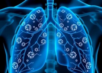 Targeted Treatments Aim to Improve Outcomes for Serious Lung Infections