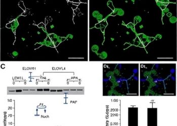 TMEM135 Deficiency Prevents Intestinal Fat Buildup Through ELOVL6-Driven PPARα Lipid Oxidation