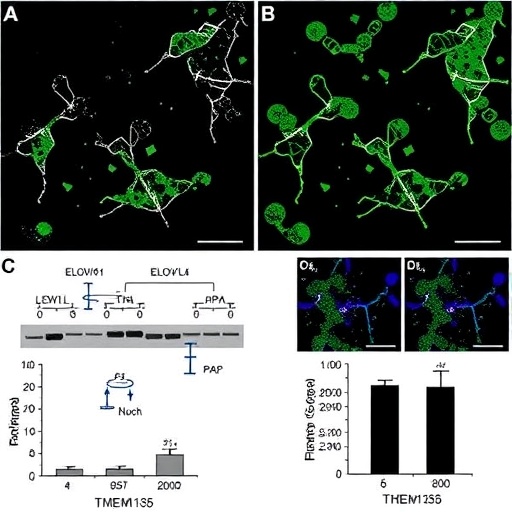 TMEM135 Deficiency Prevents Intestinal Fat Buildup Through ELOVL6-Driven PPARα Lipid Oxidation