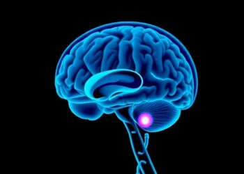 Traumatic Brain Injury Outcomes in a Low-Resource Setting