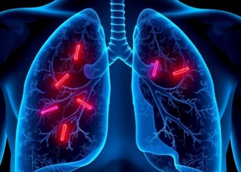Trinity study: Steroids curb inflammation in mycobacterial lung disease without weakening immunity